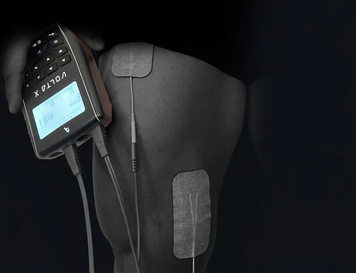 Volta X device with electrode pads on knee during ACL recovery session